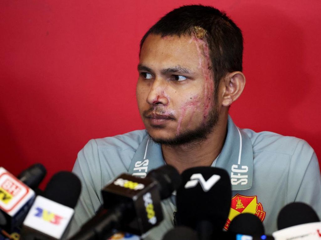 Andrie Yunus Lontarkan Pesan Tajam: "Kalian Pengecut, Saya Takkan Kalah" Usai Disiram Air Keras