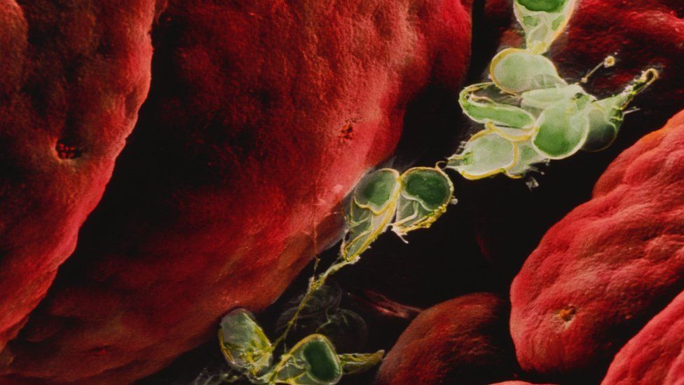 Health Alert: Record-Breaking Parasite Surge Linked to Lettuce and Salad Greens