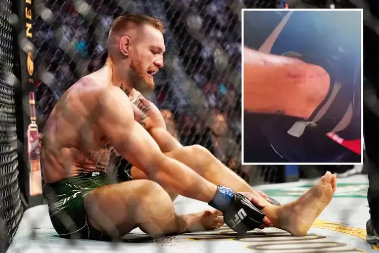 UFC 329 Aftermath: The Brutal Reality Behind Conor McGregor's Devastating Knee Injury