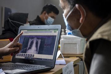 Apresiasi Inovasi Lokal: Punya Inovator Teknologi Kesehatan di Daerah Daftarkan ke DPD RI Awards 2026