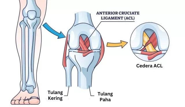 Duka Cedera ACL: Dari Kehancuran Karir NFL hingga Tragedi Bintang AFLW