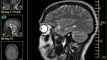 Mengungkap Sisi Lain Anatomi Manusia: Deretan Foto Medis Unik yang Menakjubkan sekaligus Mengerikan