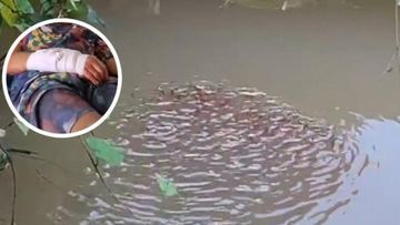 Tragedi di Perairan Thailand: Bocah Diserang Ikan Gabus Raksasa Tangannya Luka Parah Saat Bermain